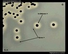 staphylococcus aureus on baird parker agar.jpg